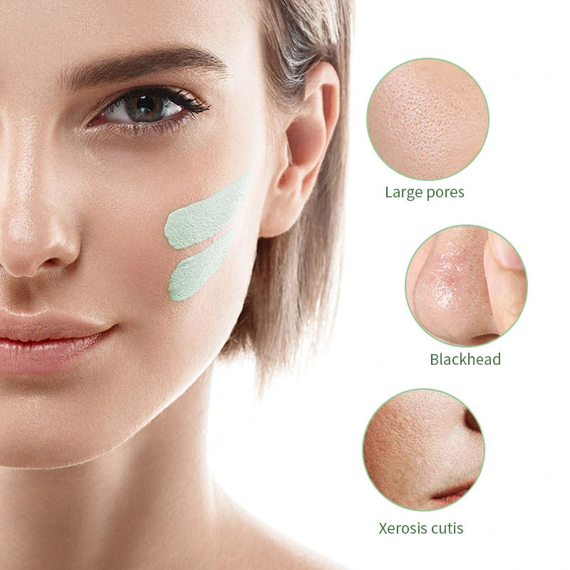 masque anti-acné pour femmes, produit foryoumer.com produit 